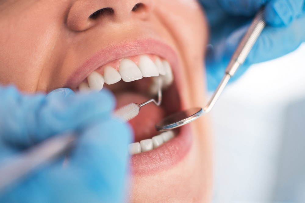 extractie masea minte bistrita, chirurgie dentara bistrita, extractii dentare bistrita, neomedica or
